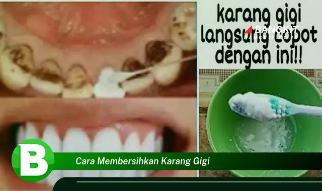 Intip Rahasia Kebersihan Karang Gigi yang Jarang Diketahui