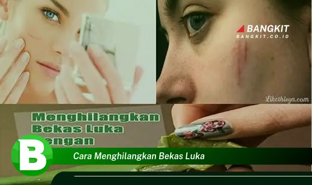 Intip Hal Rahasia Cara Menghilangkan Bekas Luka yang Wajib Kamu Intip