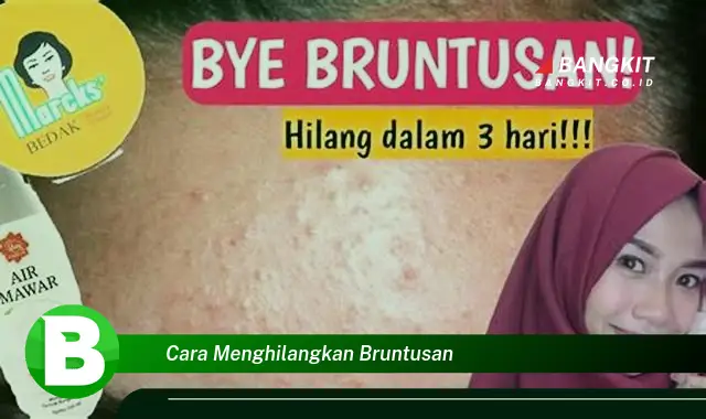 Intip Hal Penting Tentang Menghilangkan Bruntusan yang Wajib Kamu Ketahui