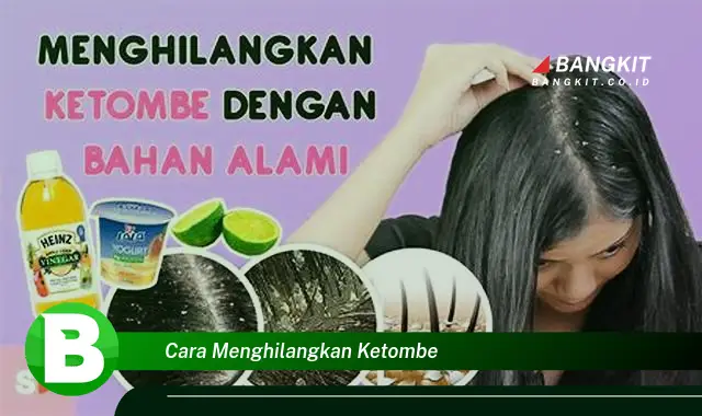 Intip Hal Menarik tentang Cara Menghilangkan Ketombe yang Jarang Dikenal