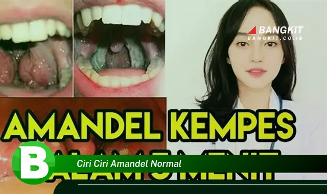 Ketahui Ciri Ciri Amandel Normal yang Wajib Kamu Intip