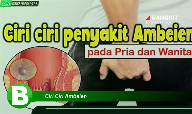 Intip Ciri-ciri Ambeien yang Jarang Diketahui