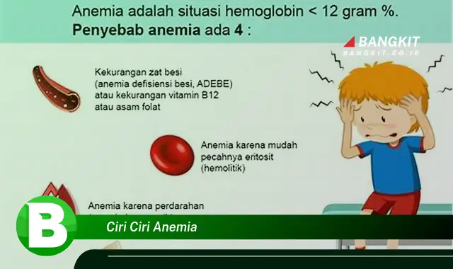 Ketahui Ciri Ciri Anemia yang Wajib Kamu Intip