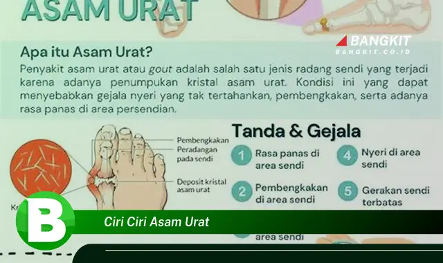 Intip Ciri-ciri Asam Urat yang Bikin Kamu Penasaran