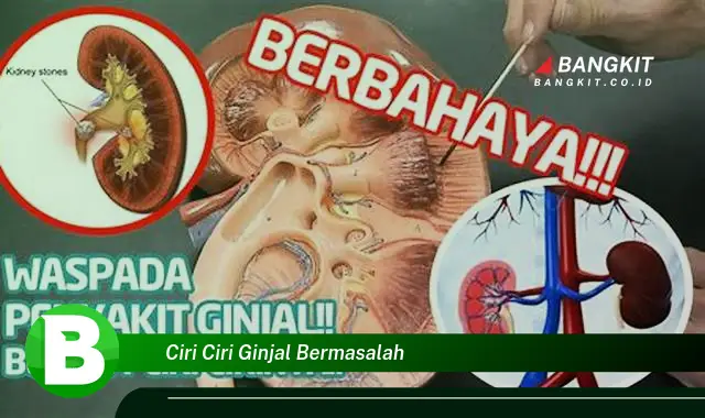 Intip Ciri Ciri Ginjal Bermasalah yang Wajib Kamu Ketahui