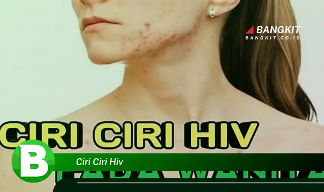 Intip Ciri-Ciri HIV yang Wajib Kamu Ketahui