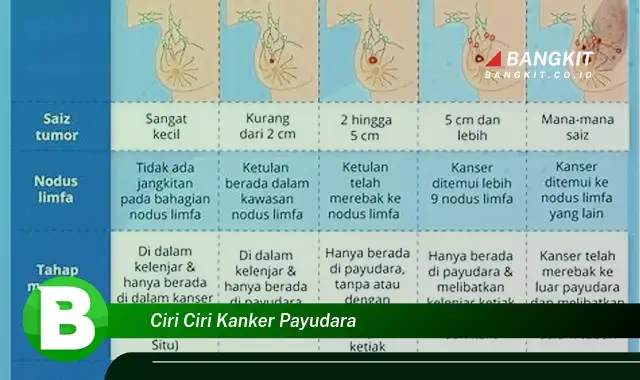 Intip Ciri Ciri Kanker Payudara yang Bikin Kamu Penasaran