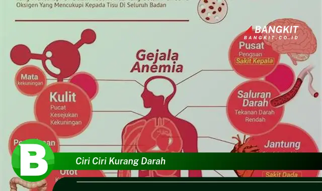 Ketahui Ciri-ciri Kurang Darah yang Wajib Kamu Intip