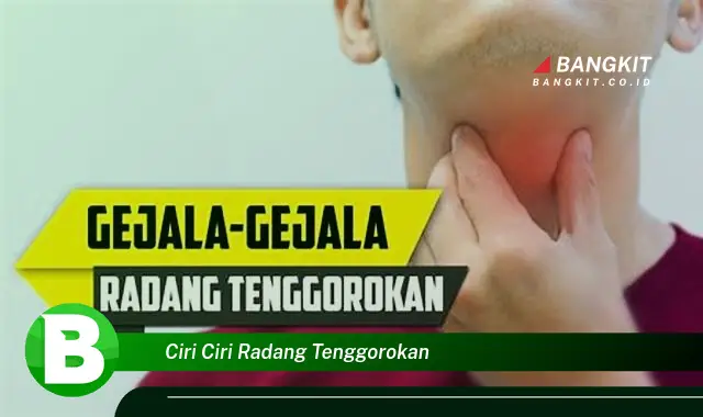 Intip Ciri-ciri Radang Tenggorokan yang Jarang Diketahui