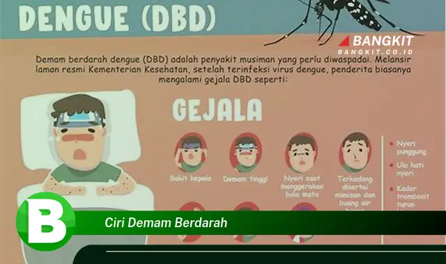 Intip Ciri Demam Berdarah yang Wajib Kamu Tahu