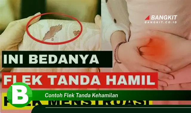 Intip Contoh Flek Tanda Kehamilan yang Jarang Diketahui