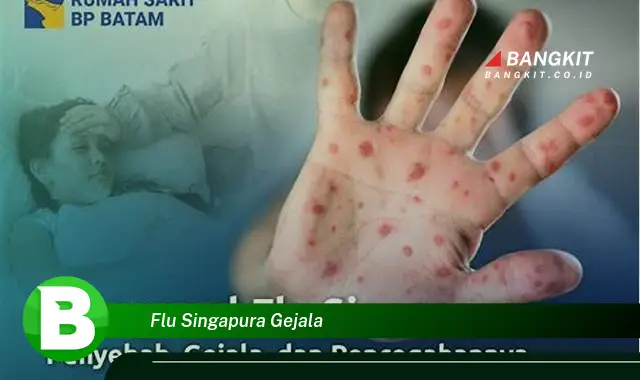 Ketahui Hal Tentang Flu Singapura Gejala Yang Wajib Kamu Ketahui