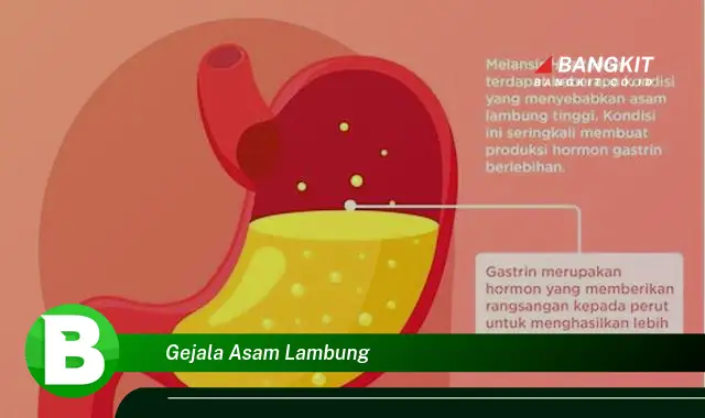 Intip Hal Mengejutkan Tentang Gejala Asam Lambung yang Bikin Kamu Penasaran