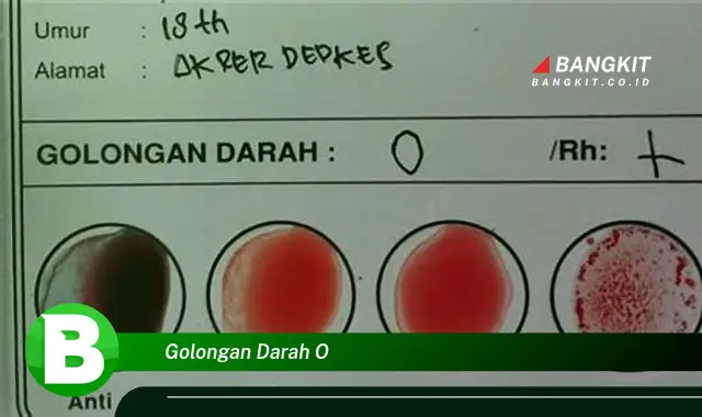 Intip Hal Golongan Darah O yang Wajib Kamu Ketahui