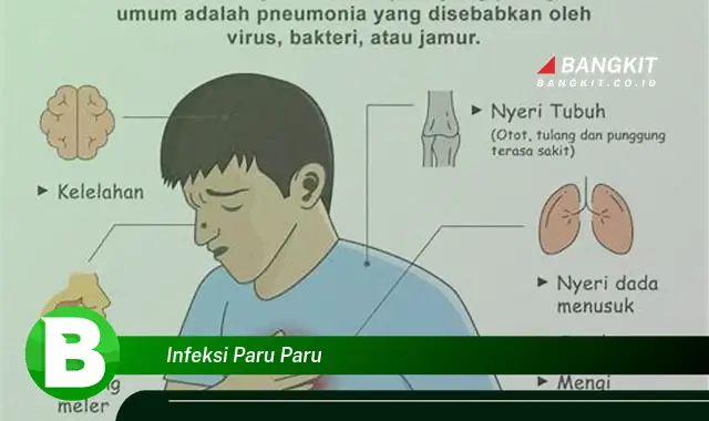 Intip Rahasia Infeksi Paru Paru yang Jarang Diketahui