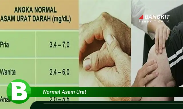 Intip Hal Penting tentang Normal Asam Urat yang Jarang Diketahui