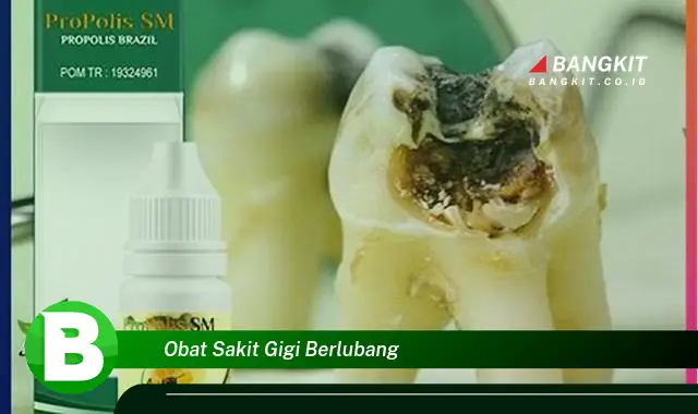 Ketahui Rahasia Mengatasi Sakit Gigi Berlubang yang Jarang Diketahui