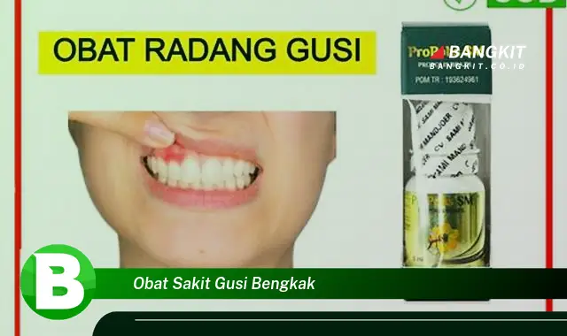 Intip Hal Rahasia Obat Sakit Gusi Bengkak yang Wajib Kamu Ketahui