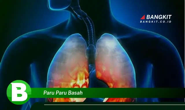 Intip Hal Tentang Paru-paru Basah yang Jarang Diketahui