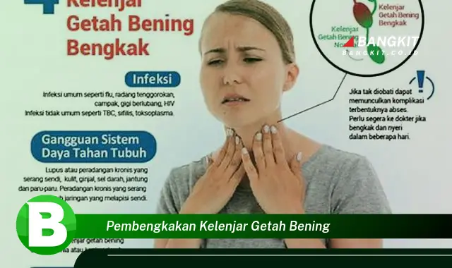 Intip Hal Penting Tentang Pembengkakan Kelenjar Getah Bening yang Wajib Kamu Intip