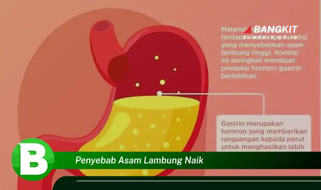 Intip Hal Tentang Penyebab Asam Lambung Naik yang Jarang Diketahui