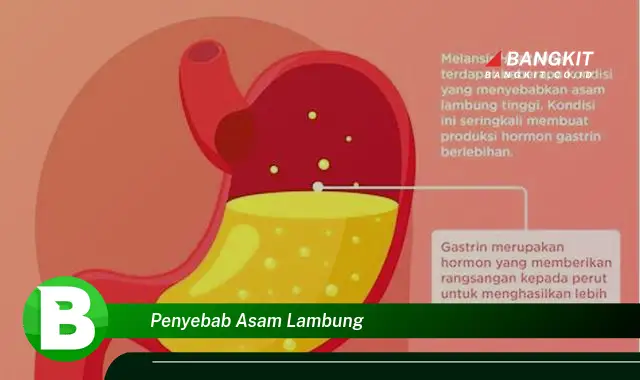 Intip Penyebab Asam Lambung yang Wajib Kamu Ketahui