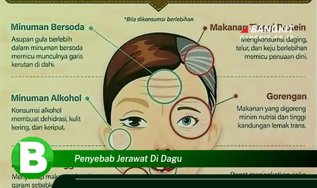 Ketahui Penyebab Jerawat di Dagu yang Wajib Kamu Intip