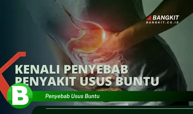 Intip Penyebab Usus Buntu yang Bikin Kamu Penasaran