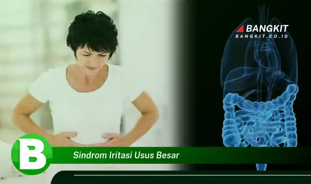 Ketahui Fakta Mencengangkan tentang Sindrom Iritasi Usus Besar yang Bikin Kamu Penasaran