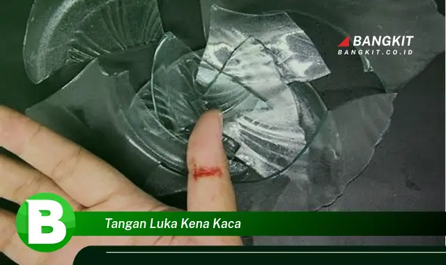 Intip Hal Mencengangkan yang Wajib Kamu Ketahui Saat Tangan Luka Kena Kaca