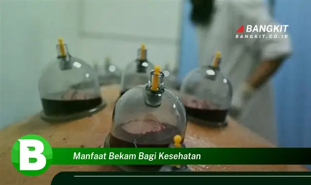 Temukan Manfaat Bekam untuk Kesehatan yang Bikin Kamu Penasaran