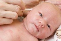 Cara Membersihkan Kotoran Pada Telinga Bayi