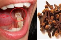 Obat Tradisional Sakit Gigi Terbukti Ampuh